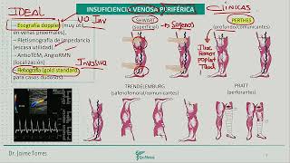 Cardiología  Insuficiencia venosa periferica TVP [upl. by Abbot]