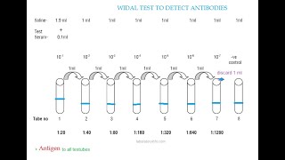 Microbiology 321 h Salmonella Typhoid Lab Diagnosis Widal test 2 [upl. by Nisior429]