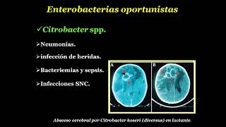 Enterobacterias oportunistas Acinetobacter spp [upl. by Dorolice155]