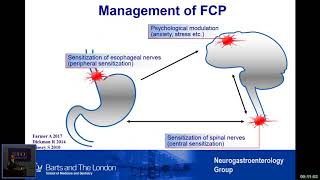 Rome IV New diagnostic criteria for functional esophageal disorders by Qasim Aziz [upl. by Juxon425]