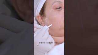 Profhilo Treatment Explained Hydrate and Rejuvenate Your Skin at Image Clinic [upl. by Aamsa]