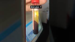 Bilirubin kitna hailab technologist status labstatus shorts pathology bloodtest scienceaiims [upl. by Marena160]