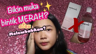 REVIEW SNP PEPTARONIC TONER  Bagus gak sih [upl. by Anaillil]