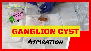 Ganglion Cyst Aspiration on a Homemade Demo [upl. by Maclean605]