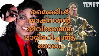 The disease that changed Michael Jacksons life TENETMALAYALAM [upl. by Joli]