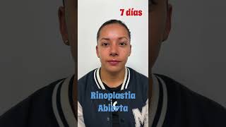 rinoplastia lipoescultura aumentomamas aumentogluteo liftingfacial blefaroplastia otoplastia [upl. by Hadria]