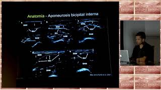 2018 diagnóstico ecográfico en las lesiones del tendón distal del bíceps [upl. by Crocker5]