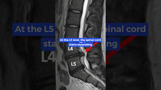 Spinal cord structure at L5 [upl. by Seidnac]