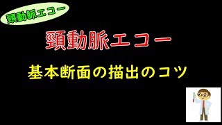 【頸動脈エコー】基本的な出し方と血管の走行。 [upl. by Llewop]