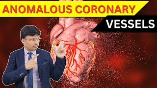 ANOMALOUS CORONARY VESSELS What You NEED to Know [upl. by Adiaj262]