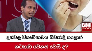 දත්වල විකෘතිතාවය නිවැරදි කළොත් කටහඬ වෙනස් වෙයි ද [upl. by Flagler897]