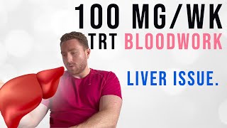 My Blood Work on 100mg Testosterone per Week [upl. by Bearce]