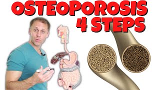 4 Steps to Improve Osteoporosis [upl. by Eusassilem602]