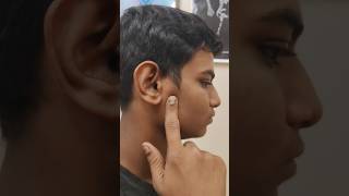 Ringing in ears Ear problem physio treanding shortvideo shorts physioterapy [upl. by Firahs]