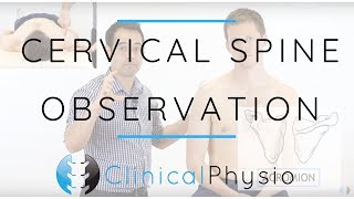 Cervical Spine Observation  Clinical Physio Premium [upl. by Hufnagel]