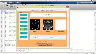 Image Fusion Using Curvelet Transform Matlab Project with Source Code [upl. by Kellsie]