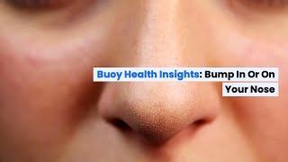 Bump in or on Your Nose Common Causes and When to Seek Medical Care  BuoyHealthcom [upl. by Dorree]