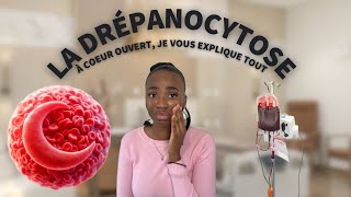 LA DRÉPANOCYTOSE À COEUR OUVERT  JE VOUS DIS TOUT [upl. by Collar]