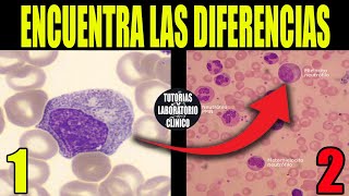 🩸Cómo Identificar Células Sanguíneas INMADURAS de la LÍNEASerie BLANCAHematología Medicina🔬 [upl. by Htebsil861]