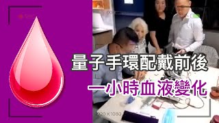 量子手環配戴前後一小時血液變化量子手環 warrenslove 量子科技 量子力学 [upl. by Ytisahcal]