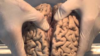 Introduction Neuroanatomy Video Lab  Brain Dissections [upl. by Aleakim]