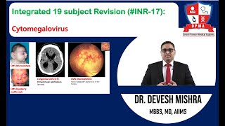 🕉 Integrated 19 subject Revision INR17 Cytomegalovirus by Dr Devesh Mishra [upl. by Zared308]