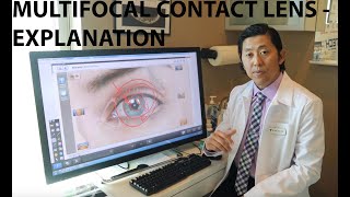 Healthy Eyes Optometry Multifocal Contact Lens Explanation [upl. by Htide]