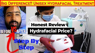 Big Difference Unisex Hydrafacial Treatment Before and After Results  Hydrafacial Price in India [upl. by Pega844]