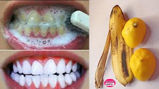 At home teeth whitening diy in 3 minutes  fastest way to whiten teeth at home  lemon banana peels [upl. by Guevara]