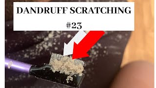 Dandruff scratching 23 [upl. by Gambrill]