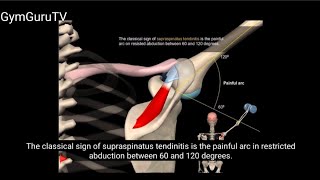 Shoulder impingement syndrome GymGuruTV [upl. by Vonni]