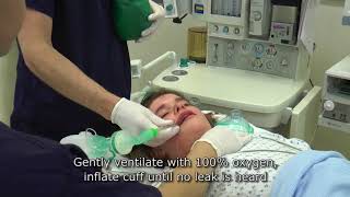 Paediatric Anaesthetics Chapter 3  Intubation rsi child [upl. by Rosdniw324]