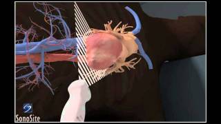 How To Apical 4Chamber View Echocardiography 3D Video [upl. by Paola]