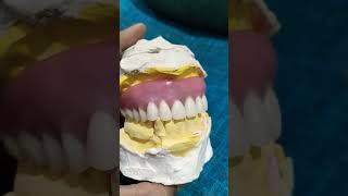 Upper Removable Denture Ready For Flasking rpddentalprocedure completedenture [upl. by Hamfurd118]