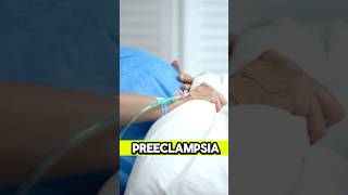 Líquidos intravenosos en Preeclmpsia 🤰🏻 emergency ciencia [upl. by Eledoya]