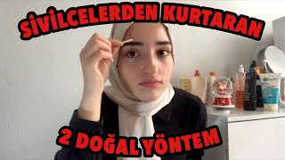 SİVİLCELERDEN 1 GECEDE KURTARAN 2 DOĞAL ÇÖZÜM EVDE [upl. by Phebe23]