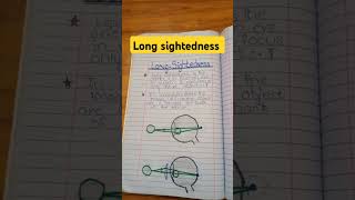 Long sightedness explained class eyes disease eye problem [upl. by Nisay393]