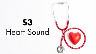 S3 Heart Sound  MEDZCOOL [upl. by Alraep]