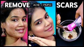 Exercise foodshair care home treatment to cure hair fall hair loss dandruff tamilDr Karthikeyan [upl. by Eerdna]