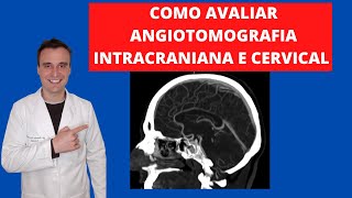 Angiotomografia arterial intra e extra craniana para residentes e estudantes de medicina [upl. by Cavallaro]