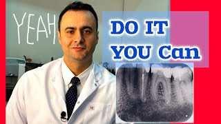 Secrets of Mastering Calcified Molar Endodontics [upl. by Ayor]