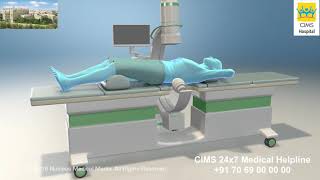 Extracorporeal Shock Wave Lithotripsy ESWL – CIMS Hospital [upl. by Lynnett]