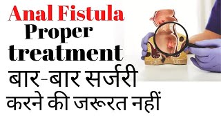 Fistula ka best treatment kya hai [upl. by Smiga]