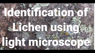 Identification of Lichen using Light microscope [upl. by Brackett]