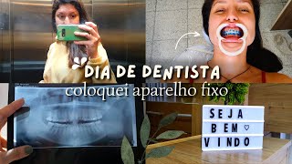 coloquei aparelho ortodôntico  primeiras impressões  VLOG 🦷✨ [upl. by Binny]