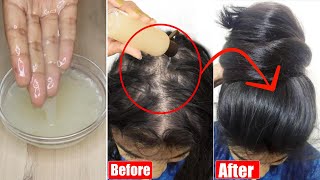 Triple Hair Growth Boosting Gelगंजे सर में भी बाल वापिस उगाये💯Thick Dense Long HairNo Hairfall [upl. by Leeann]