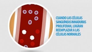 Informacion de la Leucemia [upl. by Harle]