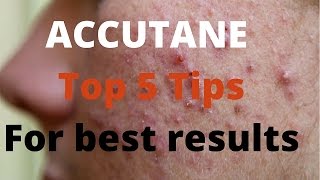 Accutane 5 tips by Dermatologists [upl. by Nonez826]