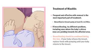 Common Breast Complications during Lactation [upl. by Larimer]