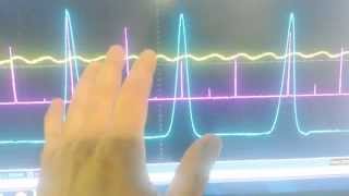 Pressure Transducers for Automotive Oscilloscope testing [upl. by Adnert]